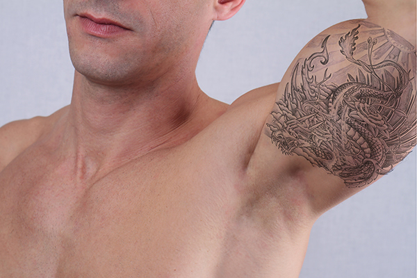 Male tattoo removal treatment in Bracknell