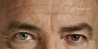 Glabella (between eyebrows) - Before Treatment