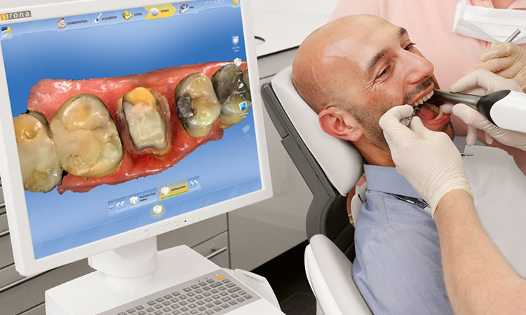 CEREC same day crowns near me at CrownWood Dental Bracknell