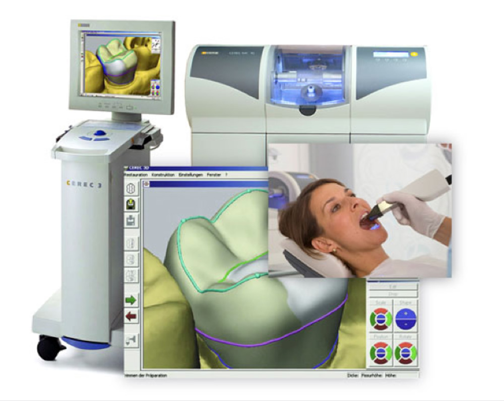 Cerec at CrownWood Dental