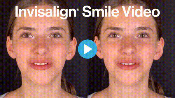 Invisalign AI