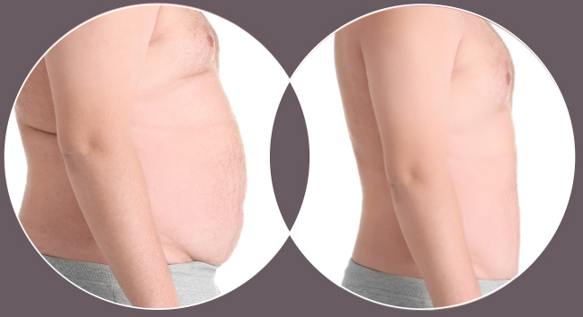 Semaglutide weight loss injections near me