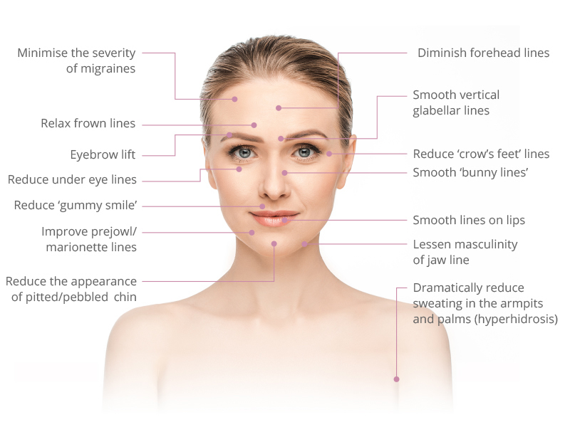 anti wrinkle injections Berkshire