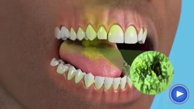 WebPakOnline Bad Breath