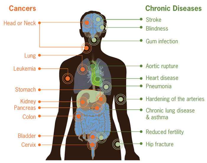 Smoking can damage every part of your body